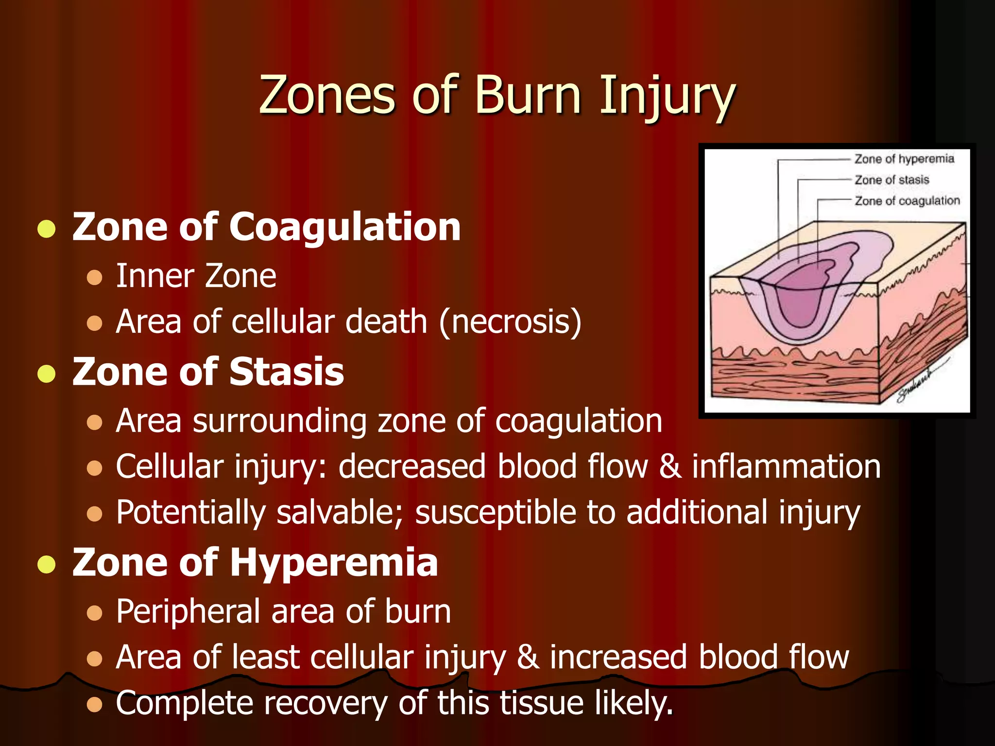 Zones of Burn Injury
 Zone of Coagulation
 Inner Zone
 Area of cellular death (necrosis)
 Zone of Stasis
 Area surrounding zone of coagulation
 Cellular injury: decreased blood flow & inflammation
 Potentially salvable; susceptible to additional injury
 Zone of Hyperemia
 Peripheral area of burn
 Area of least cellular injury & increased blood flow
 Complete recovery of this tissue likely.
 