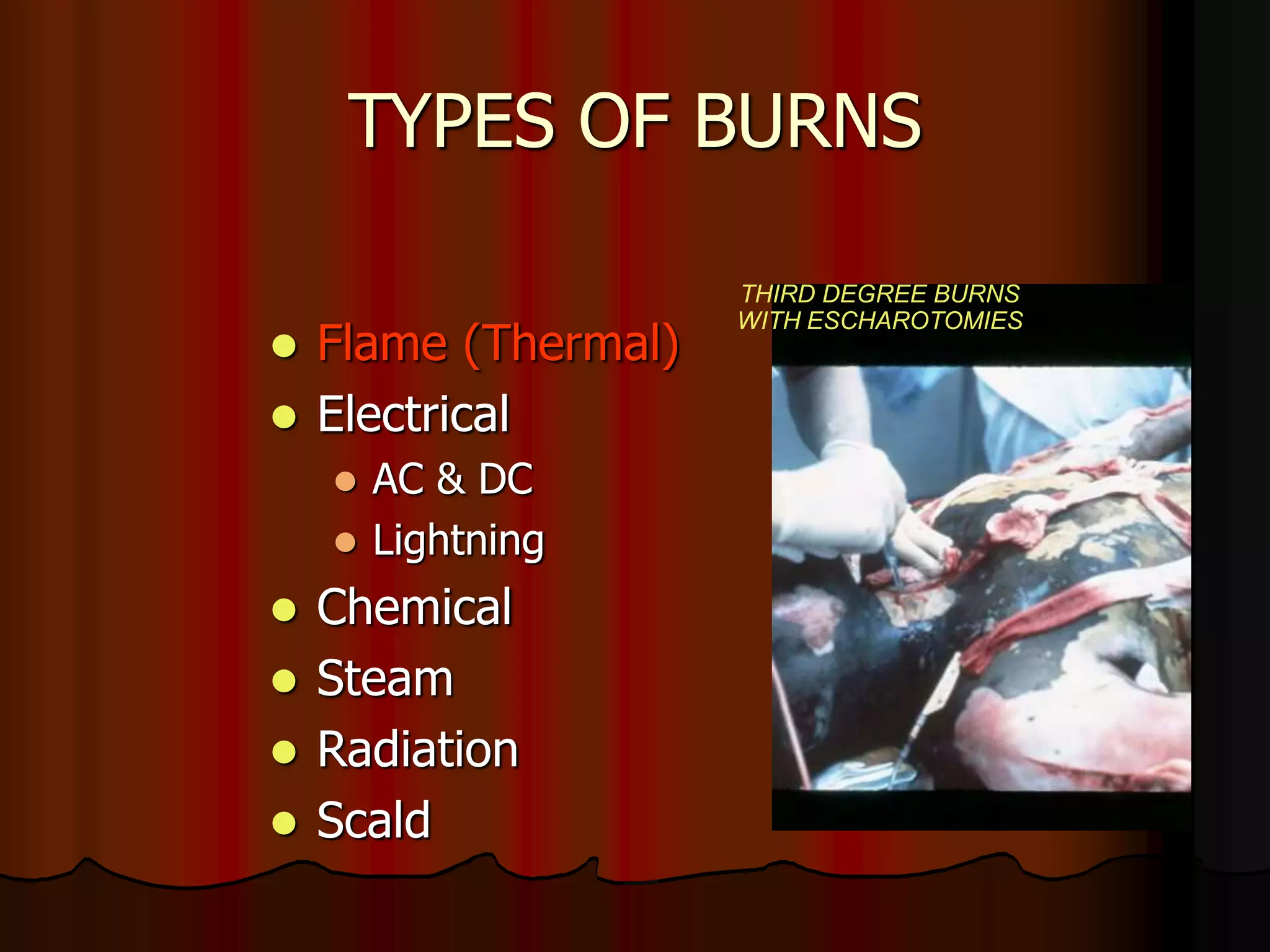TYPES OF BURNS
 Flame (Thermal)
 Electrical
 AC & DC
 Lightning
 Chemical
 Steam
 Radiation
 Scald
COURTESY DAVID
EFFRON, M.D.
THIRD DEGREE BURNS
WITH ESCHAROTOMIES
 
