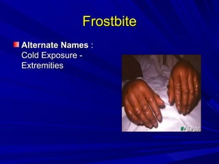 Burns and freezing | PPT