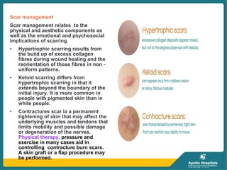 BURNS AND ITS MANAGEMENT.pptx PREPARED BY NEHA KEWAT | PPTX