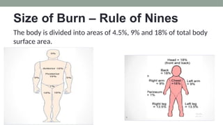 Burn Net Types TYPES OF BURNS AND HOW TO MANAGEMENT AND TREAT .pptx