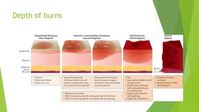 Burns and scalds PPTX First Aid Injuries