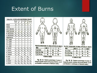 Extent of Burns
 