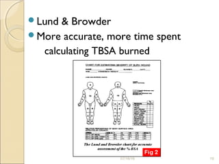 07/16/16 19
Lund & Browder
More accurate, more time spent
calculating TBSA burned
 