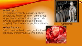 Heat rigor:-
It is observed mainly in muscles. There is
generalized flexion of trunk , arms &legs
.upper limbs held out with fingers curled
inwards assembling attitude of boxer
{pugilist} .This is refers as pugilistic attitude.
Heat fracture:-
Due to intense heat bones get fractured
especially cranial vaults & limb bones.
 