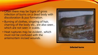 • Often there may be Signs of gross
infection of burns on a dead body with
discoloration & pus formation.
• Burning of clothes, singeing of hair,
charring of the body etc., are also seen ,
which are not seen in scalds.
• Heat ruptures may be evident , which
must not be confused with the
antemortem incised wounds.
 