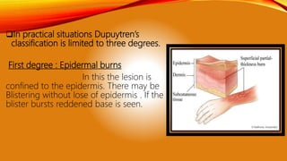 In practical situations Dupuytren’s
classification is limited to three degrees.
First degree : Epidermal burns
In this the lesion is
confined to the epidermis. There may be
Blistering without lose of epidermis . If the
blister bursts reddened base is seen.
 