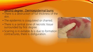 • Second degree : Dermoepidermal burns
• There is a destruction of full thickness of the
skin.
• The epidermis is coagulated or charred.
• There is a central zone of necrotic tissue
surrounded by first degree
• Scarring is in evitable & is due to formation
contractures, there is disfiguration.
 