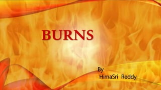 BURNS
By
HimaSri Reddy
 