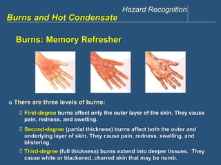 Hazard Recognition 
www.discountppe.com 
Burns and Hot Condensate 
Burns: Memory Refresher 
 There are three levels of burns: 
 First-degree burns affect only the outer layer of the skin. They cause 
pain, redness, and swelling. 
 Second-degree (partial thickness) burns affect both the outer and 
underlying layer of skin. They cause pain, redness, swelling, and 
blistering. 
 Third-degree (full thickness) burns extend into deeper tissues. They 
cause white or blackened, charred skin that may be numb. 
 