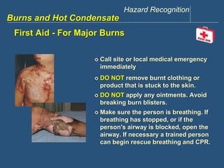 Hazard Recognition 
www.discountppe.com 
Burns and Hot Condensate 
First Aid - For Major Burns 
 Call site or local medical emergency 
immediately 
 DO NOT remove burnt clothing or 
product that is stuck to the skin. 
 DO NOT apply any ointments. Avoid 
breaking burn blisters. 
 Make sure the person is breathing. If 
breathing has stopped, or if the 
person's airway is blocked, open the 
airway. If necessary a trained person 
can begin rescue breathing and CPR. 
 