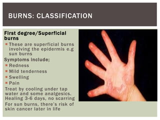First degree/Superficial
burns
 These are superficial burns
involving the epidermis e.g
sun burns
Symptoms include;
 Redness
 Mild tenderness
 Swelling
 Pain
Treat by cooling under tap
water and some analgesics.
Healing 3-6 days, no scarring
For sun burns, there’s risk of
skin cancer later in life
BURNS: CLASSIFICATION
 