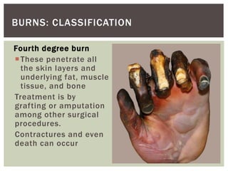 Fourth degree burn
These penetrate all
the skin layers and
underlying fat, muscle
tissue, and bone
Treatment is by
grafting or amputation
among other surgical
procedures.
Contractures and even
death can occur
BURNS: CLASSIFICATION
 