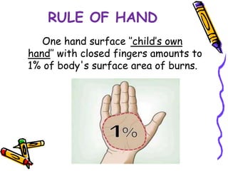 Burns in children | PPTX