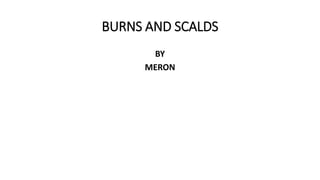 BURNS AND SCALDS
BY
MERON
 