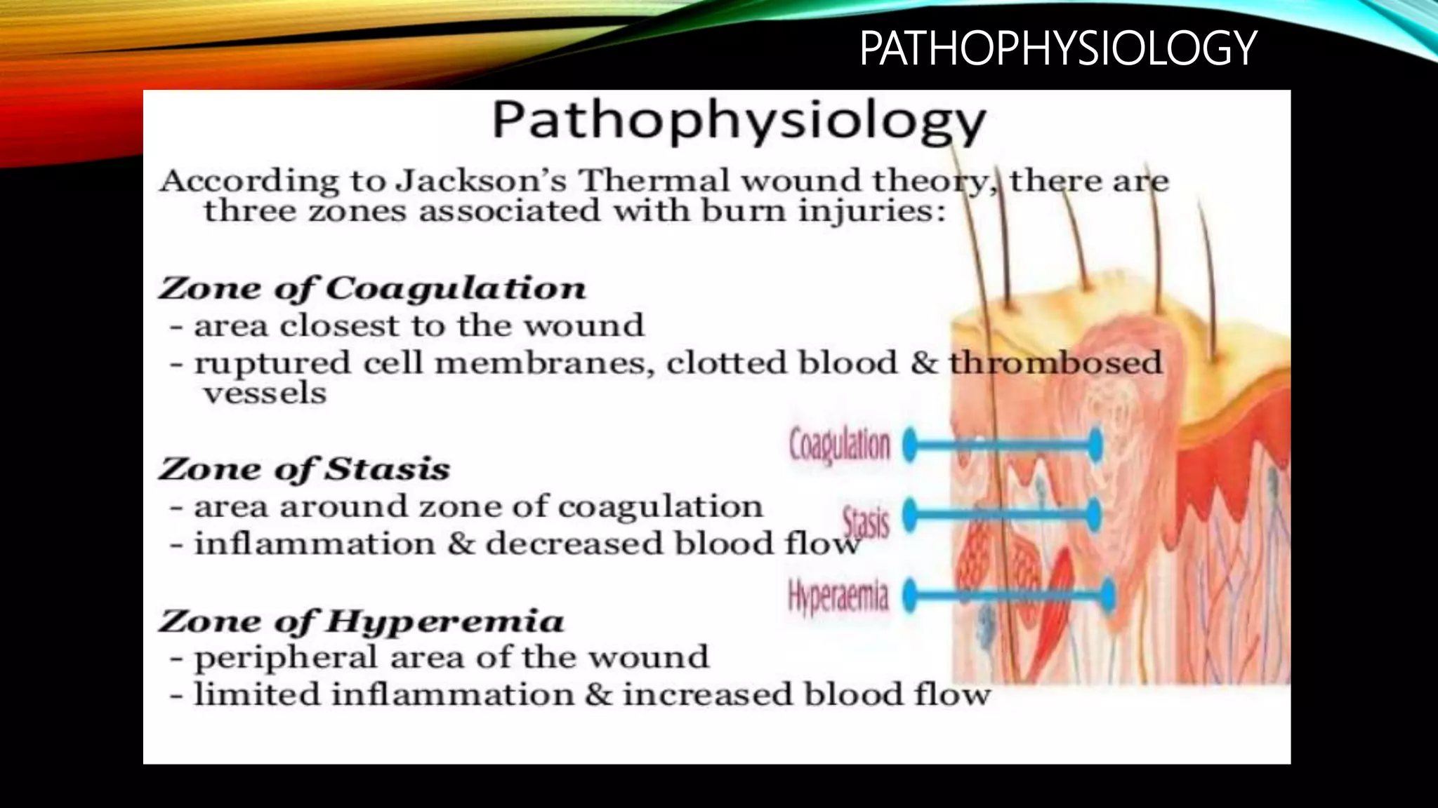 Burns in pediatrics presentation | PPTX | First Aid | Injuries