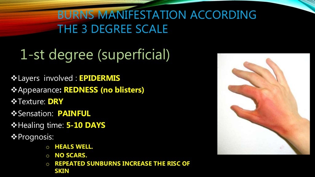 Burns in pediatrics presentation