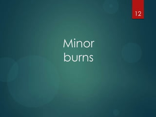 12

Minor
burns

 