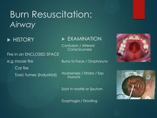 Burn Resuscitation:
Airway


HISTORY



EXAMINATION

Confusion / Altered
Consciousness

Fire in an ENCLOSED SPACE
e.g. House fire

Burns to Face / Oropharynx

Car fire
Toxic fumes (Industrial)

Hoarseness / Stridor / Exp
rhonchi
Soot in nostrils or Sputum
Dysphagia / Drooling

 