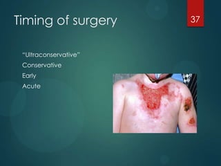 Timing of surgery
“Ultraconservative”
Conservative
Early

Acute

37

 