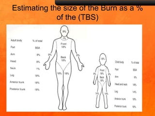 Estimating the size of the Burn as a %
of the (TBS)
 