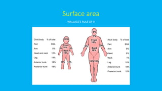 Surface area
WALLACE’S RULE OF 9
 