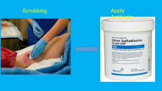 Apply
Antibiotic
Scrubbing
 