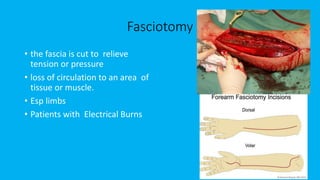 Fasciotomy
• the fascia is cut to relieve
tension or pressure
• loss of circulation to an area of
tissue or muscle.
• Esp limbs
• Patients with Electrical Burns
 