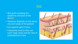 SSG
• Skin graft including the
epidermis and part of the
dermis.
• Thickness depends on the donor
site and needs of the patient
• Can expand upto 9 times
• Frequently used as they can
cover large areas and the rate of
autorejection is low.
 
