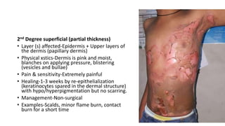 2nd Degree superficial (partial thickness)
• Layer (s) affected-Epidermis + Upper layers of
the dermis (papillary dermis)
• Physical xstics-Dermis is pink and moist,
blanches on applying pressure, blistering
(vesicles and bullae)
• Pain & sensitivity-Extremely painful
• Healing-1-3 weeks by re-epithelialization
(keratinocytes spared in the dermal structure)
with hypo/hyperpigmentation but no scarring.
• Management-Non-surgical
• Examples-Scalds, minor flame burn, contact
burn for a short time
 