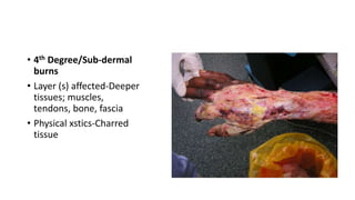 • 4th Degree/Sub-dermal
burns
• Layer (s) affected-Deeper
tissues; muscles,
tendons, bone, fascia
• Physical xstics-Charred
tissue
 