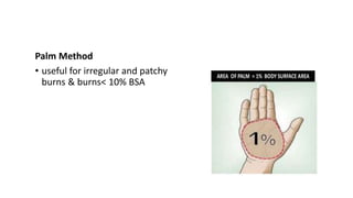 Palm Method
• useful for irregular and patchy
burns & burns< 10% BSA
 