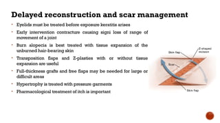 Delayed reconstruction and scar management
• Eyelids must be treated before exposure keratitis arises
• Early intervention contracture causing signi loss of range of
movement of a joint
• Burn alopecia is best treated with tissue expansion of the
unburned hair-bearing skin
• Transposition flaps and Z-plasties with or without tissue
expansion are useful
• Full-thickness grafts and free flaps may be needed for large or
difficult areas
• Hypertrophy is treated with pressure garments
• Pharmacological treatment of itch is important
 