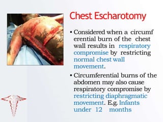 Normal Burn Pattern Skeleton BURNS TYPES AND ITS MANAGEMENT | PPTX