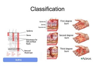 Classification
 