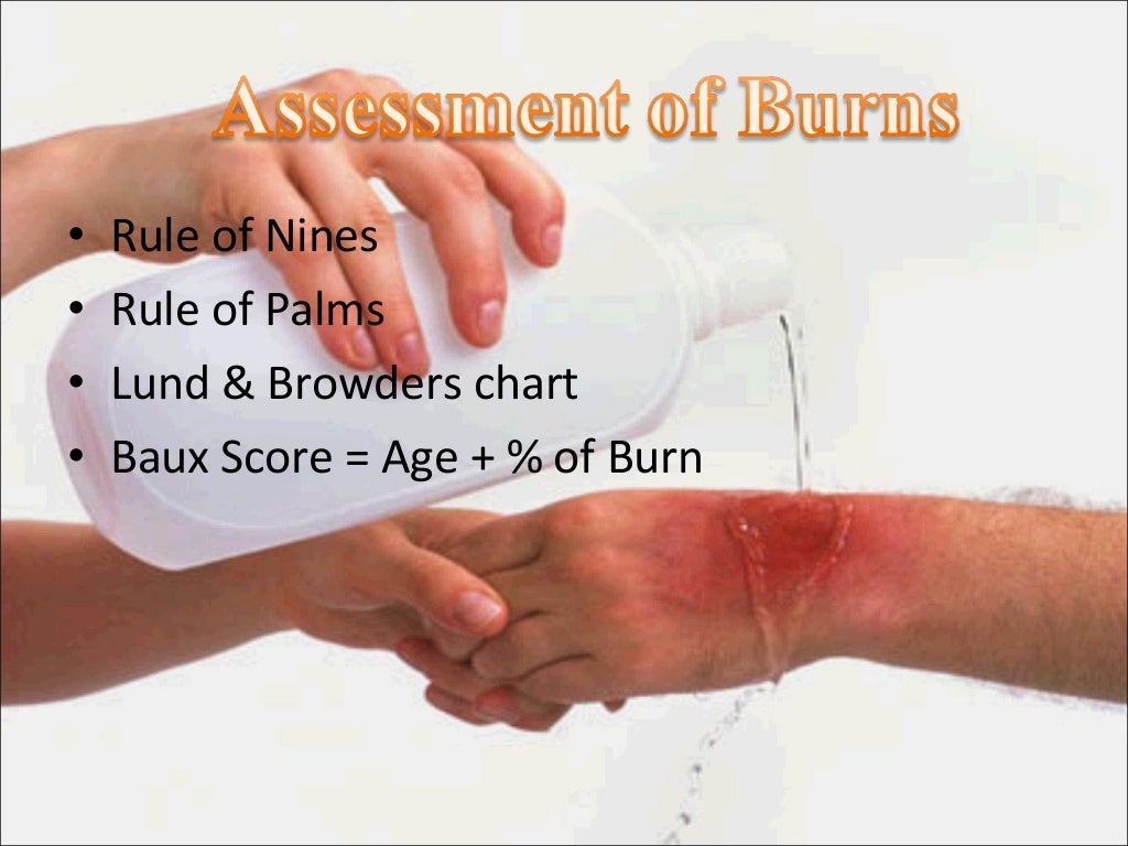 Pathophysiology, Nutritional Management of BURNS
