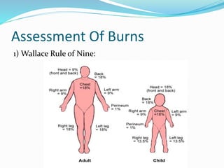 BURNS | PPTX
