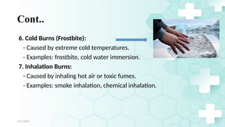 Jamal 10
Cont..
6. Cold Burns (Frostbite):
- Caused by extreme cold temperatures.
- Examples: frostbite, cold water immersion.
7. Inhalation Burns:
- Caused by inhaling hot air or toxic fumes.
- Examples: smoke inhalation, chemical inhalation.
4/21/2024
 