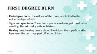 Jamal 15
FIRST DEGREE BURN
• First-degree burns, the mildest of the three, are limited to the
epidermis layer of skin.
• Signs and symptoms: These burns produce redness, pain, and minor
swelling, The skin is dry without blisters,
• Healing time: Healing time is about 3 to 6 days; the superficial skin
layer over the burn may peel off in 1 or 2 days.
4/21/2024
 