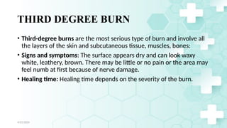 Jamal 19
THIRD DEGREE BURN
• Third-degree burns are the most serious type of burn and involve all
the layers of the skin and subcutaneous tissue, muscles, bones:
• Signs and symptoms: The surface appears dry and can look waxy
white, leathery, brown. There may be little or no pain or the area may
feel numb at first because of nerve damage.
• Healing time: Healing time depends on the severity of the burn.
4/21/2024
 