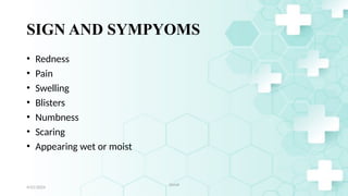 6
SIGN AND SYMPYOMS
• Redness
• Pain
• Swelling
• Blisters
• Numbness
• Scaring
• Appearing wet or moist
4/21/2024
Jamal
 