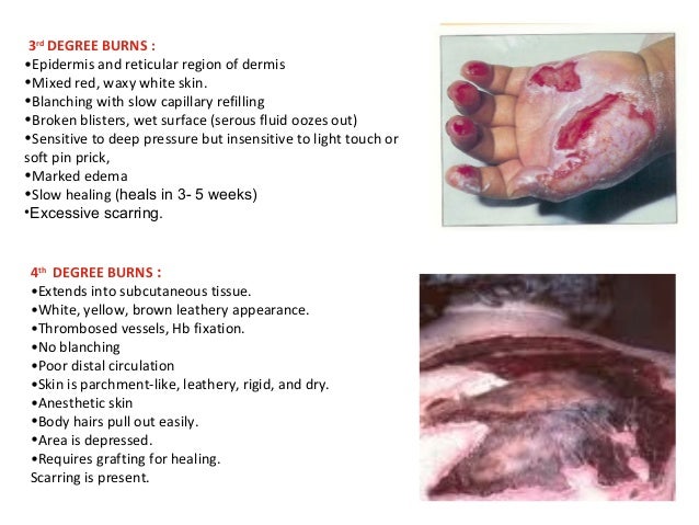 three stages of skin graft healing