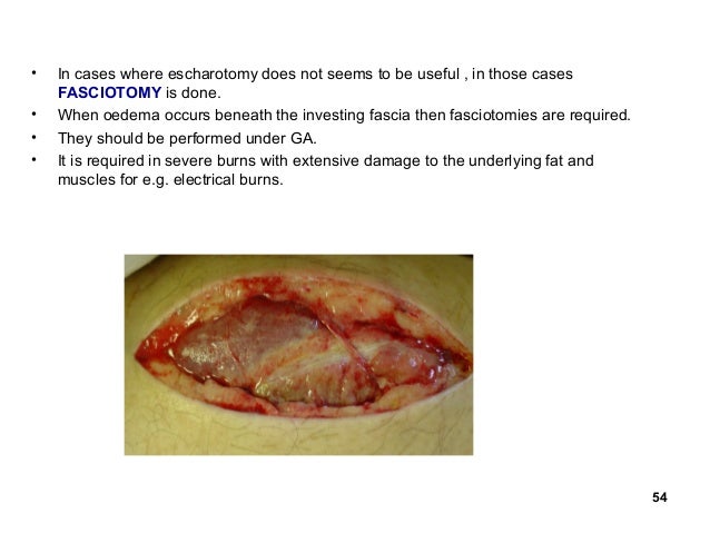 Escharotomy Burn Patient Diet