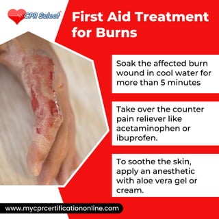First Aid Treatment for Burn