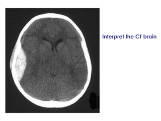 Interpret the CT brain 