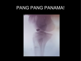 PANG PANG PANAMA!
 