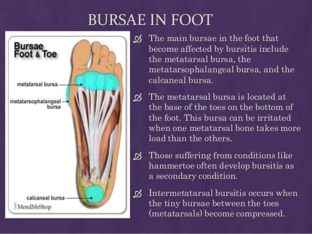 Bursare In Lower Extrimity