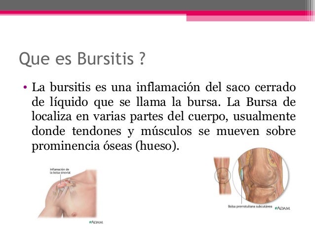 La medicina contra la psoriasis sobre la cabeza