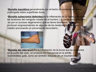 •Bursitis isquiática:generalmente por el hecho de sentarse en forma
prolongada sobre superficies duras.
•Bursitis subacromio deltoidea:es la inflamación de la bursa que cubre
los tendones del manguito rotador en el hombro. La causa más frecuente
 es por un proceso degenerativo que se llama tendinosis, en que se
producen engrosamientos de algunos de los tendones del manguito
rotador provocando un pinzamiento secundario.




•Bursitis del olécranon:Es la inflamación de la bursa que se encuentra
en la punta del codo, se produce con frecuencia en la artritis
reumatoidea, gota, como así también después de un traumatismo.
 