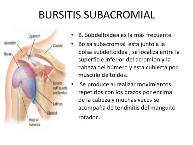 BURSITIS SUBACROMIAL SUBDELTOIDEA PDF